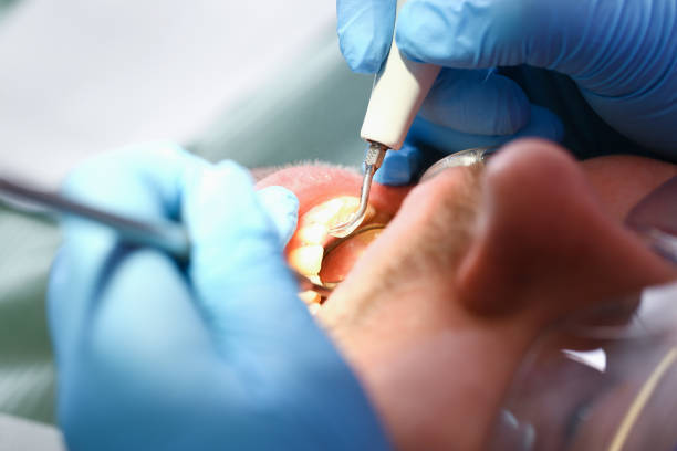 Best Emergency Gum Treatment in Palestine, IL