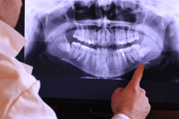 Best Cosmetic Emergency Dentistry in Palestine, IL