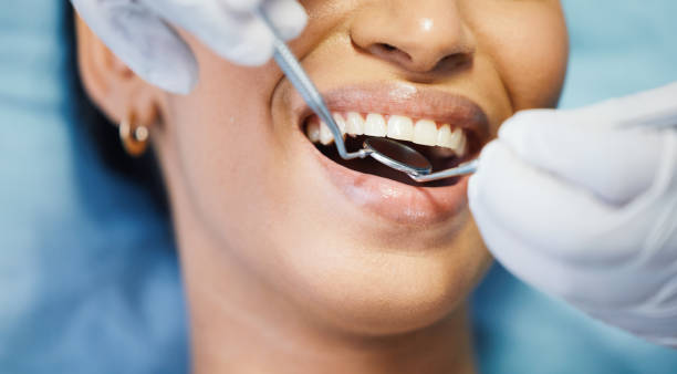 Best Emergency Root Canal Treatment in Palestine, IL